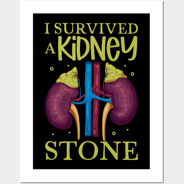 I have survived a kidney stone Wall Art by Modern Medieval Design